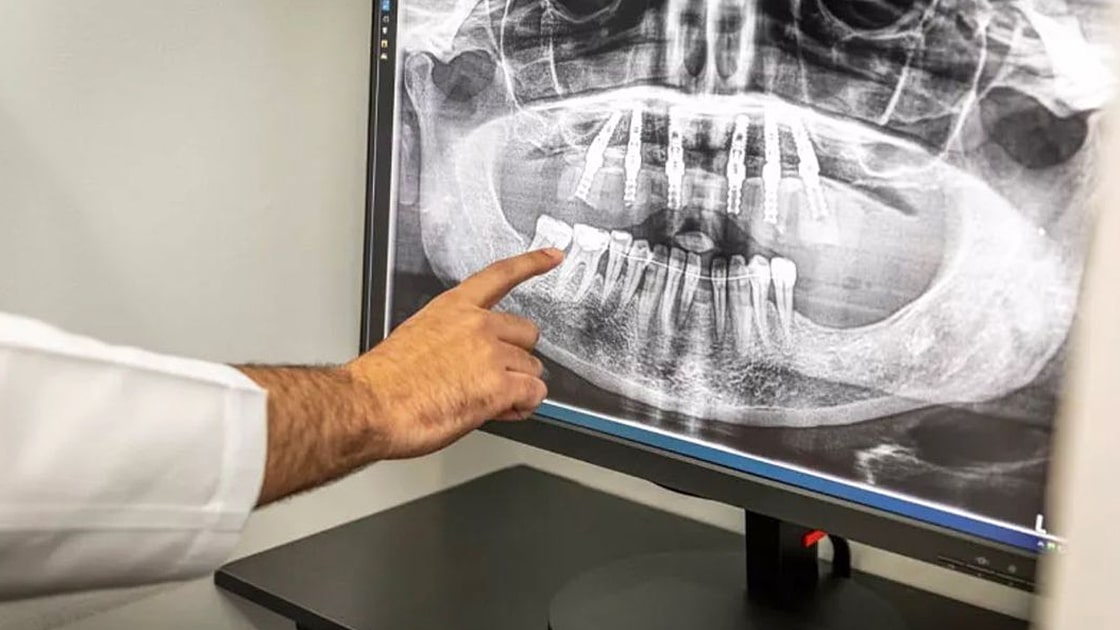 Technology Cbct Photo